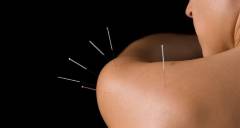 acupuncture for women